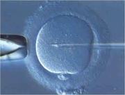 Best ICSI Treatment India 