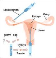 Test Tube Baby Treatment India