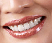 Affordable Dental Implants India