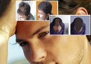 Popular Skin and hair treatments at Ambrosia Clinic, Hyderabad
