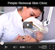 Acne Pimple Peel Treatment @ Pimples Hyderabad