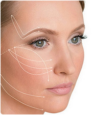 Fine Thread Contour Lift Chandigarh