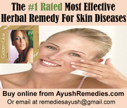 Solve The Problem Of Acne Herbally And Naturally