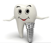 Best Dental Implants at Low Cost in Hyderabad, India