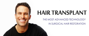 Hair Transplant in Chandigarh