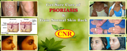 CNR HERBS | Treatment for Psoriasis chennai| Cnr Herbs in chennai