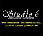 Fue Hair Transplantation in Chandigarh