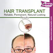 Hair Doctor in Ahmedabad for Hair Fall Problem