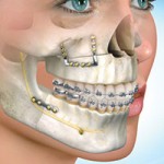 Dental Clinic in Jaipur