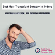 Hair Transplant Surgeons in Indore