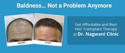 Hair transplant less than half cost