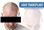 How to find the Hair Transplant In Nawanshahr?