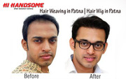 Hair Wig in Patna | Hair Weaving in Patna | Hair Wig Clinic in in Patn