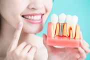 Benefits of Going for Adult Orthodontic Treatment
