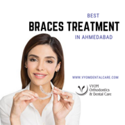 Best Orthodontist in Ahmedabad