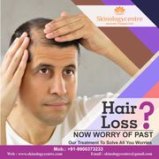 Best Hair Transplant Clinic in Bangalore - Skinology Centre