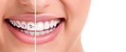 Top Dentist in Trivandrum