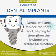 Dental Implant Clinic in Gurgaon