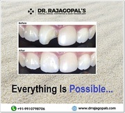 Child Dentist in Gurgaon