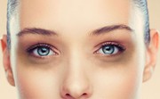 Find Under Eyes Dark Circles Treatment in Ludhiana