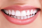 Smile Makeover Dental Clinic in Kerala