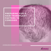Preparing For A Hair Transplant: Factors To Consider 
