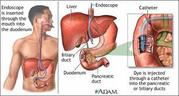 Gastroscopy Colonoscopy ERCP Stone Clinic in Jaipur