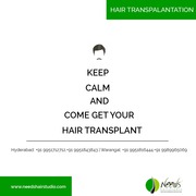 best non-surgical hair replacement cost for men