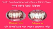 Cosmetic Dentistry in Kolkata-Teeth Care Multispeciality Dental Clinic