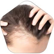 Hair loss treatment
