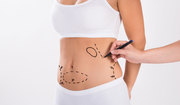 Best Liposuction Clinic in Indore