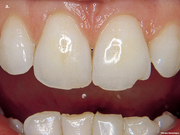 Dental Mammoth offers to its customers valuable oral health content