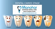 Manohar dental care teeth whitening doctor in vizag