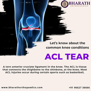  Arthritis Treatment 