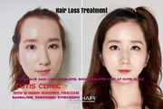 Hair Transplantation & Skin Care Doctor Clinic in Kochi,  Trivandrum