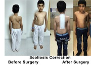Best Spine Specialist in Delhi