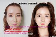 Hair & Skin Treatment Best Doctor Clinic in Kochi