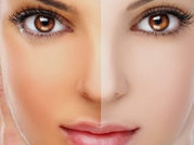 Skin Lightening Treatment Cost in Delhi