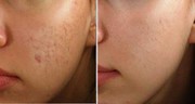 Best dermatologist in Delhi