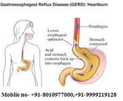 Gastroenterologist in West Delhi
