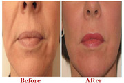 Best Plastic Surgeon in Delhi