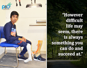 Artificial Leg In Delhi