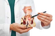 Laser Treatment for Fistula Cost in Coimbatore