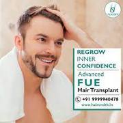 Best hair transplant treatment in delhi