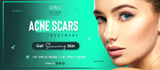 Get Healthy Skin,  Consult Now!