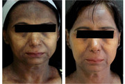 Best Cosmetic Surgeon in Delhi | Dr. Vivek Kumar