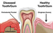 Periodontist In Ahmedabad