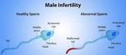 Best Fertility Clinic in Delhi
