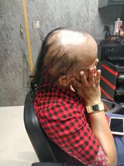 Hair Wigs in Delhi - Ladies Hair Wigs Shop Service in Delhi