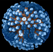 Swine flu and its symptoms 